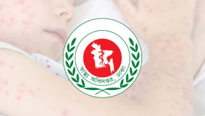 হাম উপসর্গে ৮ জনের মৃত্যু, নতুন আক্রান্ত ১,০৬৫
