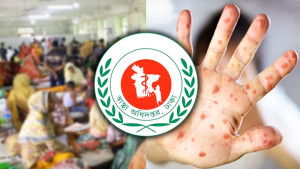 হাম ও উপসর্গে আরও ৭ জনের মৃত্যু